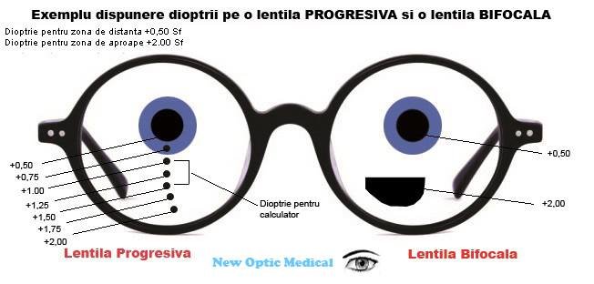 New Optic Medical - Optica medicala, reparatii ochelari